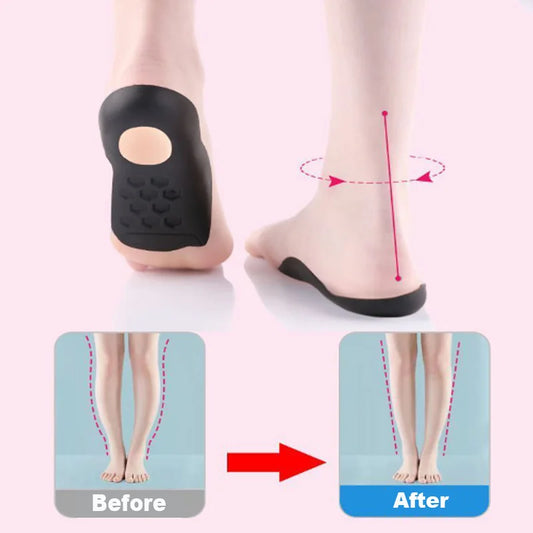 1Pair Orthopedic Insoles for Flat Feet Arch insole Walking Pad Arch Support Shock-absorbing Pressure-relieving Walking Foot Care